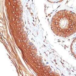 Invitrogen PERP Recombinant Rabbit Monoclonal Antibody (1O3L5) 100 &mu;L;
