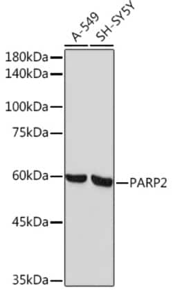 Invitrogen PARP2 Recombinant Rabbit Monoclonal Antibody (6G5U7) 100 &mu;L;