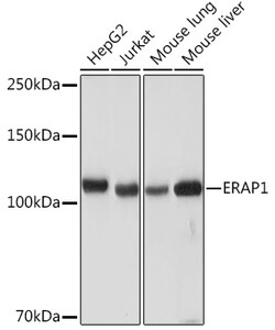 Invitrogen ARTS1 Recombinant Rabbit Monoclonal Antibody (6V8C0) 100 &mu;L;