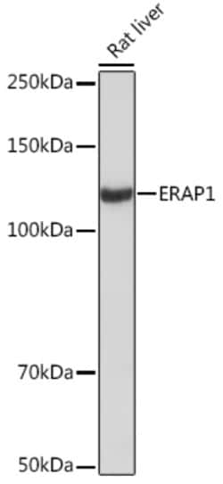 Invitrogen ARTS1 Recombinant Rabbit Monoclonal Antibody (6V8C0) 100 &mu;L;