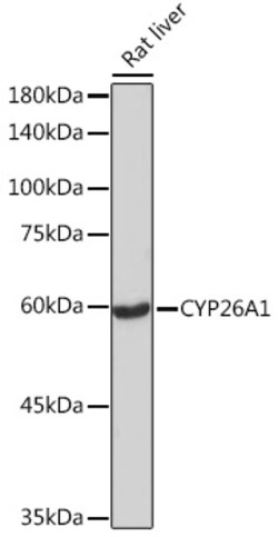 Invitrogen CYP26A1 Recombinant Rabbit Monoclonal Antibody (1E1D2) 100 &mu;L | Buy Online | Invitrogen&trade; | Fisher Scientific