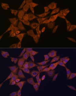 Invitrogen Syntaxin 4 Recombinant Rabbit Monoclonal Antibody (8F3P7) 100