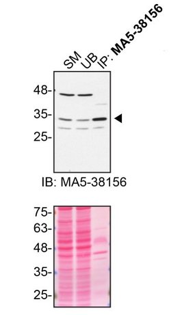 Invitrogen Syntaxin 4 Recombinant Rabbit Monoclonal Antibody (8F3P7) 100