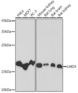 Invitrogen LMO4 Recombinant Rabbit Monoclonal Antibody (5C0I1) 100 &mu;L | Buy Online | Invitrogen&trade; | Fisher Scientific