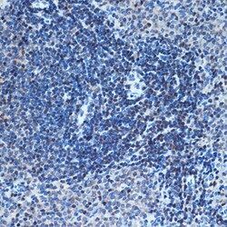 Invitrogen CHD3 Recombinant Rabbit Monoclonal Antibody (8Z6L6) 100 &mu;L;