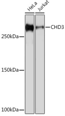 Invitrogen CHD3 Recombinant Rabbit Monoclonal Antibody (8Z6L6) 100 &mu;L;