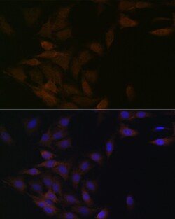 Invitrogen PP2A alpha/beta Recombinant Rabbit Monoclonal Antibody (4J2Z8) 100 &mu;L | Buy Online | Invitrogen&trade; | Fisher Scientific