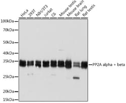 Invitrogen PP2A alpha/beta Recombinant Rabbit Monoclonal Antibody (4J2Z8) 100 &mu;L | Buy Online | Invitrogen&trade; | Fisher Scientific