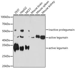 Invitrogen LGMN Recombinant Rabbit Monoclonal Antibody (6X5U6) 100 &mu;L | Buy Online | Invitrogen&trade; | Fisher Scientific