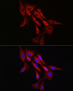 Invitrogen&trade;&nbsp;alpha Tubulin Recombinant Rabbit Monoclonal Antibody (3P2D9)