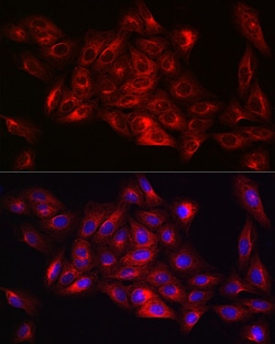 Invitrogen alpha Tubulin Recombinant Rabbit Monoclonal Antibody (3P2D9) 100 &mu;L | Buy Online | Invitrogen&trade; | Fisher Scientific