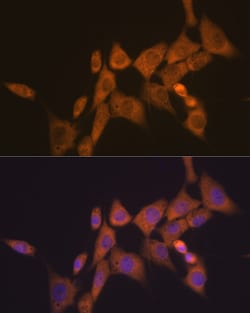 Invitrogen ATG10 Recombinant Rabbit Monoclonal Antibody (2Q3Q3) 100 &mu;L | Buy Online | Invitrogen&trade; | Fisher Scientific