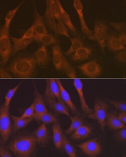 Invitrogen KARS Recombinant Rabbit Monoclonal Antibody (2V2B6) 100 &mu;L;
