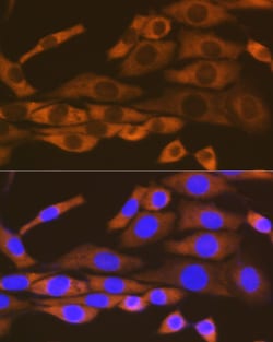 Invitrogen KARS Recombinant Rabbit Monoclonal Antibody (2V2B6) 100 &mu;L;