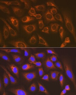 Invitrogen KARS Recombinant Rabbit Monoclonal Antibody (2V2B6) 100 &mu;L;