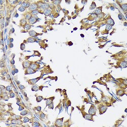 Invitrogen KARS Recombinant Rabbit Monoclonal Antibody (2V2B6) 100 &mu;L;