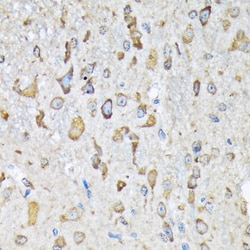Invitrogen KARS Recombinant Rabbit Monoclonal Antibody (2V2B6) 100 &mu;L;