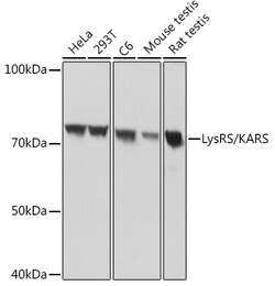 Invitrogen KARS Recombinant Rabbit Monoclonal Antibody (2V2B6) 100 &mu;L;