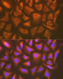 Invitrogen UAP1 Recombinant Rabbit Monoclonal Antibody (5S7M2) 100 &mu;L | Buy Online | Invitrogen&trade; | Fisher Scientific