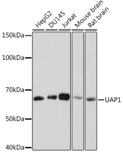 Invitrogen UAP1 Recombinant Rabbit Monoclonal Antibody (5S7M2) 100 &mu;L | Buy Online | Invitrogen&trade; | Fisher Scientific