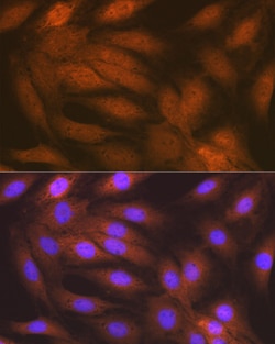 Invitrogen RAIDD Recombinant Rabbit Monoclonal Antibody (3Z9N8) 100 &mu;L;