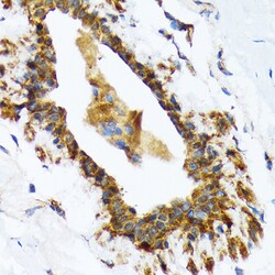 Invitrogen RAIDD Recombinant Rabbit Monoclonal Antibody (7M7M6) 100 &mu;L;