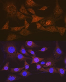 Invitrogen eIF2b epsilon Recombinant Rabbit Monoclonal Antibody (5M2D4)
