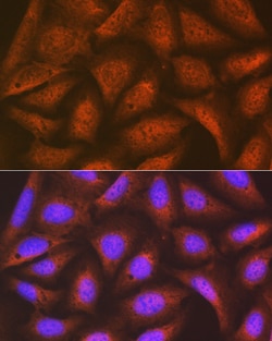 Invitrogen eIF2b epsilon Recombinant Rabbit Monoclonal Antibody (5M2D4)