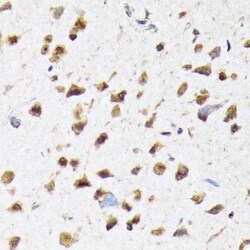 Invitrogen eIF2b epsilon Recombinant Rabbit Monoclonal Antibody (5M2D4)