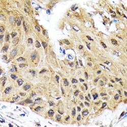 Invitrogen eIF2b epsilon Recombinant Rabbit Monoclonal Antibody (5M2D4)