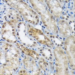 Invitrogen eIF2b epsilon Recombinant Rabbit Monoclonal Antibody (5M2D4)
