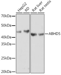 Invitrogen ABHD5 Recombinant Rabbit Monoclonal Antibody (2K8W9) 100 &mu;L;