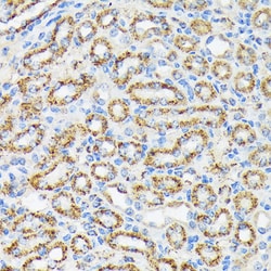 Invitrogen NDUFS4 Recombinant Rabbit Monoclonal Antibody (6T10F4) 100 &mu;L;