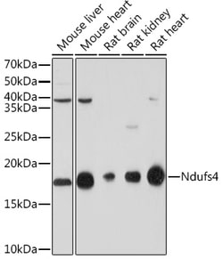 Invitrogen NDUFS4 Recombinant Rabbit Monoclonal Antibody (6T10F4) 100 &mu;L;