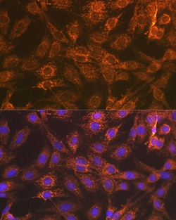 Invitrogen DIABLO Recombinant Rabbit Monoclonal Antibody (0W1K4) 100 &mu;L;