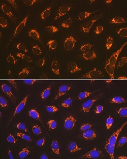Invitrogen DIABLO Recombinant Rabbit Monoclonal Antibody (0W1K4) 100 &mu;L;