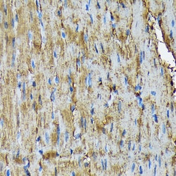 Invitrogen HSP20 Recombinant Rabbit Monoclonal Antibody (3J5N1) 100 &mu;L;