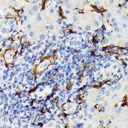Invitrogen HSP20 Recombinant Rabbit Monoclonal Antibody (3J5N1) 100 &mu;L;