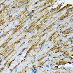 Invitrogen HSP20 Recombinant Rabbit Monoclonal Antibody (3J5N1) 100 &mu;L;