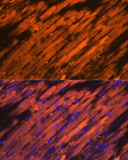 Invitrogen HSP20 Recombinant Rabbit Monoclonal Antibody (3J5N1) 100 &mu;L;