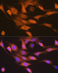 Invitrogen RPS6KB2 Recombinant Rabbit Monoclonal Antibody (5D8F5) 100 &mu;L | Buy Online | Invitrogen&trade; | Fisher Scientific