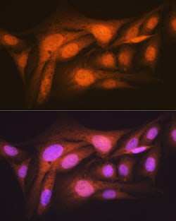 Invitrogen RPS6KB2 Recombinant Rabbit Monoclonal Antibody (5D8F5) 100 &mu;L | Buy Online | Invitrogen&trade; | Fisher Scientific