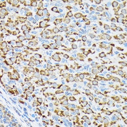 Invitrogen RPS6KB2 Recombinant Rabbit Monoclonal Antibody (5D8F5) 100 &mu;L | Buy Online | Invitrogen&trade; | Fisher Scientific