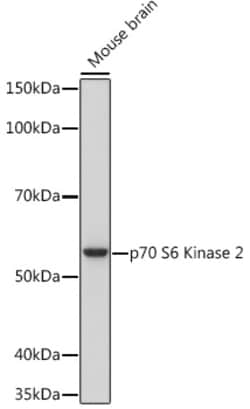 Invitrogen RPS6KB2 Recombinant Rabbit Monoclonal Antibody (5D8F5) 100 &mu;L | Buy Online | Invitrogen&trade; | Fisher Scientific