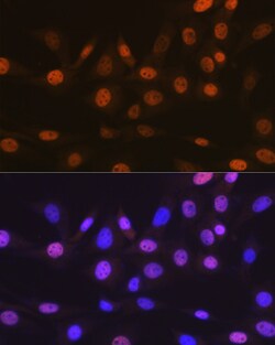 Invitrogen TRBP Recombinant Rabbit Monoclonal Antibody (9E6C9) 100 &mu;L;
