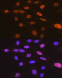 Invitrogen TRBP Recombinant Rabbit Monoclonal Antibody (9E6C9) 100 &mu;L;