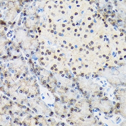 Invitrogen TRBP Recombinant Rabbit Monoclonal Antibody (9E6C9) 100 &mu;L;