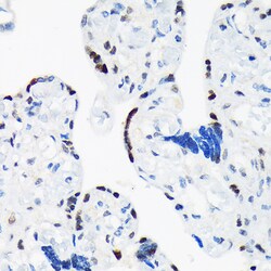 Invitrogen TRBP Recombinant Rabbit Monoclonal Antibody (9E6C9) 100 &mu;L;