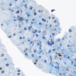 Invitrogen TRBP Recombinant Rabbit Monoclonal Antibody (9E6C9) 100 &mu;L;