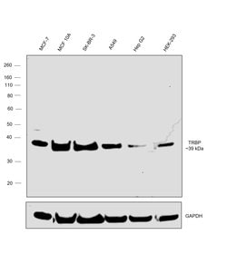Invitrogen TRBP Recombinant Rabbit Monoclonal Antibody (9E6C9) 100 &mu;L;